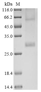 Human herpesvirus 6B G-protein coupled receptor homolog U51 Protein