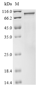 Mouse Tmc1 Protein