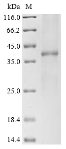 Human SLC14A1 Protein