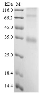 Mouse Mc4r Protein