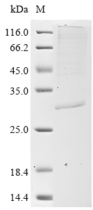 Human COMMD5 Protein