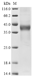 Human TRPC6 Protein