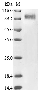 Human T273A Protein