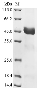 Human TRBC2 Protein