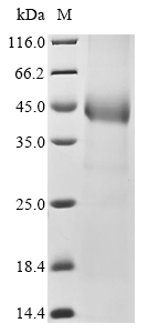 Human SVEP1 Protein