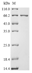 Human RPE65 Protein