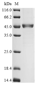 Human ACTC1 Protein