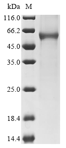 Human KRT24 Protein