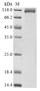 Human POLQ Protein