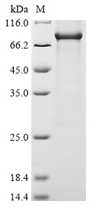 Human RIPK1 Protein