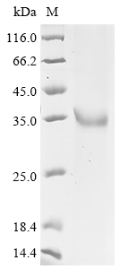 Human LDHC Protein