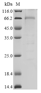 Human CES1 Protein