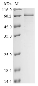 Human IGF2BP1 Protein