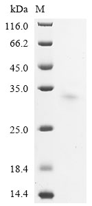 Mouse Ush2A Protein