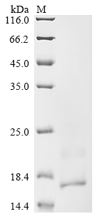 Human TRBC2 Protein
