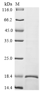 Human SARM1 Protein