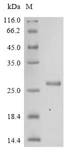 Mouse Ifi204 Protein