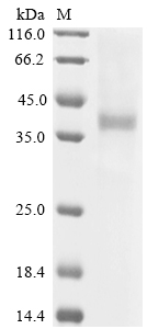 Sheep DPEP1 Protein