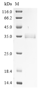 1-phosphatidylinositol phosphodiesterase Protein
