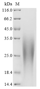 Human ZDHHC5 Protein