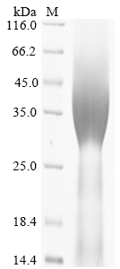 Human HOXA3 Protein