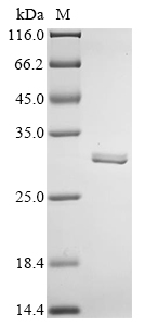 Rat Carbonic anhydrase 2 Protein