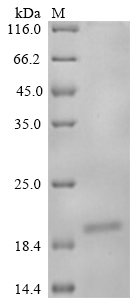 Mouse Nus1 Protein