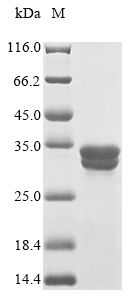 Human CCR9 Protein