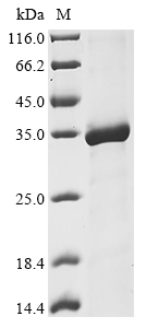 Human RAD50 Protein