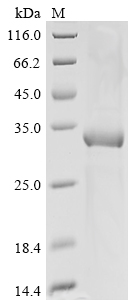 Mouse Protein IL-40 Protein