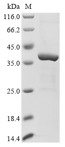 Mouse Ndst2 Protein