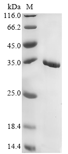 Ochrobactrum intermedium M86 TnpA IS26 Protein