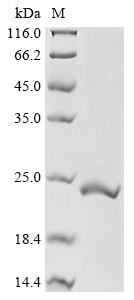 Human UCN3 Protein