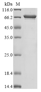 Human DNAJC5 Protein (Biotin)