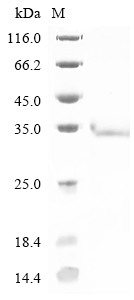 Mouse Rtn3 Protein