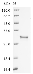Macrovipera lebetina obtusa Disintegrin obtustatin Protein