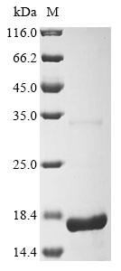 Porcine reproductive and respiratory syndrome virus Nucleoprotein Protein