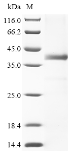 Human DCLRE1A Protein