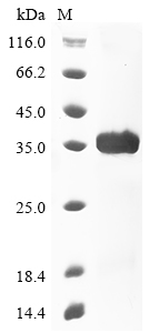 TNNI3 Protein