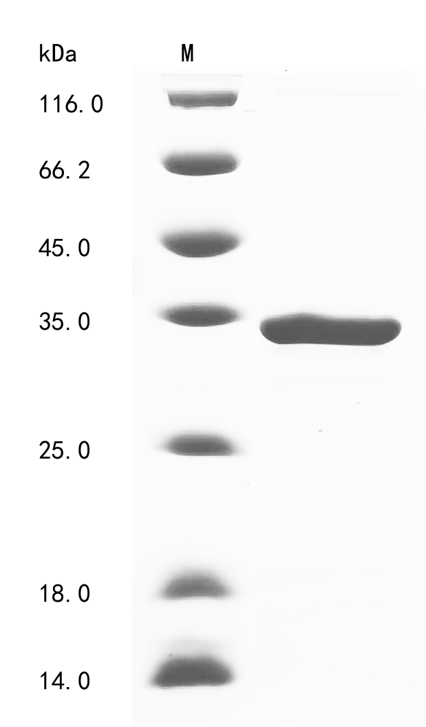 Equine TNNI3 Protein