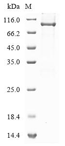 Human TRPC4AP Protein
