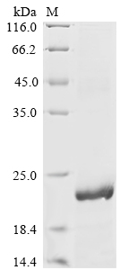 Rat Ptn Protein