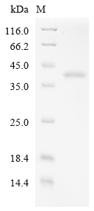 Human T273A Protein