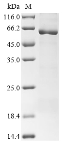 Arabidopsis thaliana Catalase-3 Protein