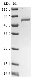 Citrobacter freundii Tyrosine phenol-lyase Protein