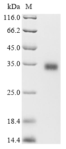 Human HPRT1 Protein
