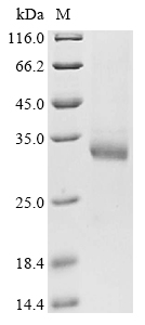 Human HPRT1 Protein