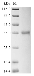 Human HPRT1 Protein