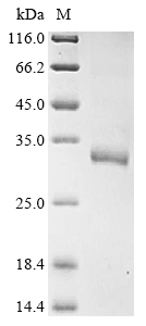 Human HPRT1 Protein