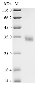 Human HPRT1 Protein